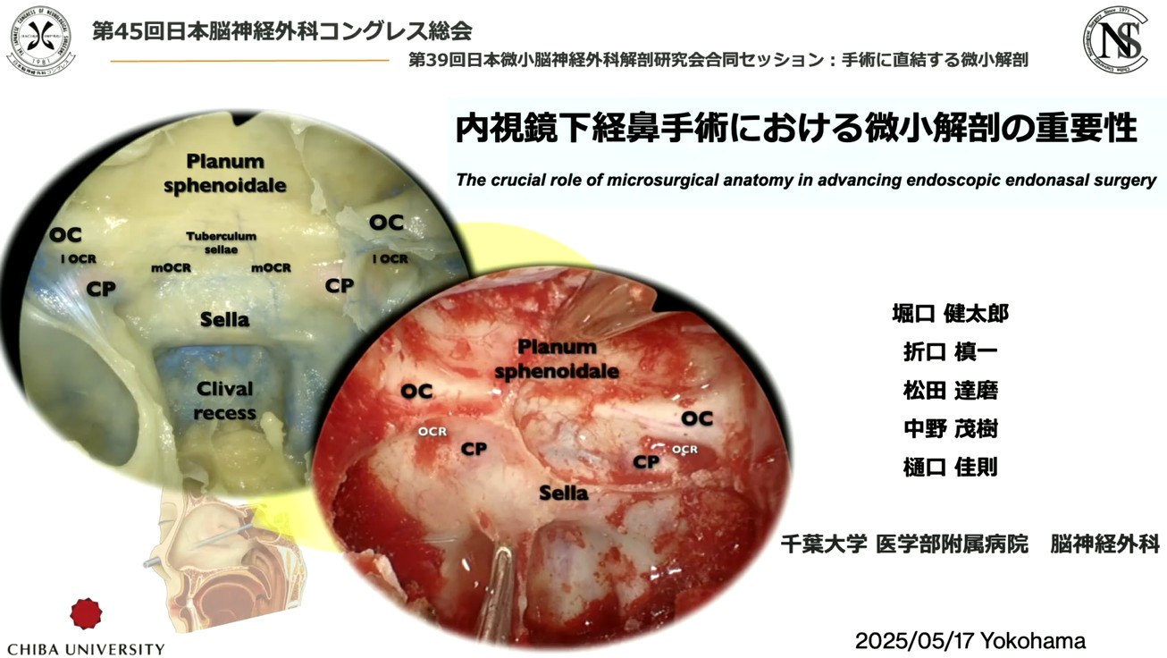 内視鏡下経鼻手術における微小解剖の重要性