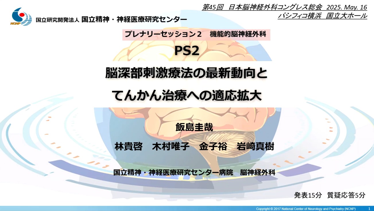 脳深部脳刺激療法の最新動向とてんかん治療への適応拡大
